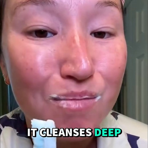 Canada’s #1 Niacinamide Whitening Toothpaste is here 🇨🇦✨ Say goodbye to yellow stains and hello to a brighter, healthier smile. ✔ Removes stubborn stains fast ✔ Strengthens enamel while whitening ✔ Dentist-approved niacinamide blend ✔ Perfect for daily use 50% Off Free Delivery Today: https://nova-smile.ca/products/whitening-toothpaste | NovaSmile