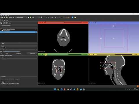 Turn your CT-Scan into a 3D model with Slicer