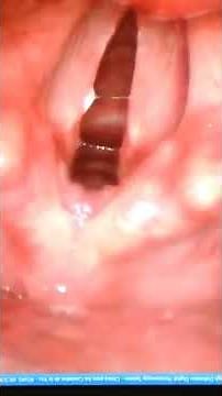 ¿Sabes cómo funcionan tus cuerdas vocales?
