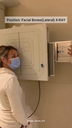 Understanding Facial Bones Through Lateral X-RAY Images