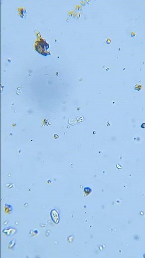 An Amoeba Crawling (2.5× Speed) #microscope