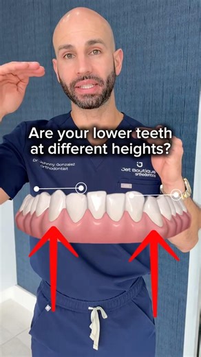 Are your lower teeth at different heights? This is how we’re solving that with Invisalign.