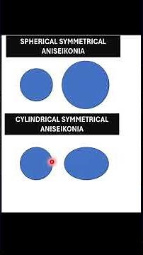 Types Of Aniseikonia | Barrel, Pin cushion, Oblique and Prismatic