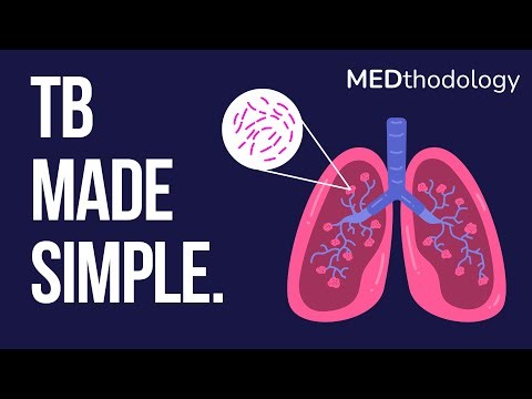 Tuberculosis Made Simple: Pathophysiology, Diagnosis, and Treatment