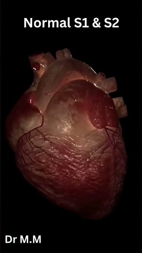 Normal Heart Sounds S1 & S2 Explained (Master Cardiac Auscultation!)