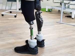 Catalyst: Bionic Revolution