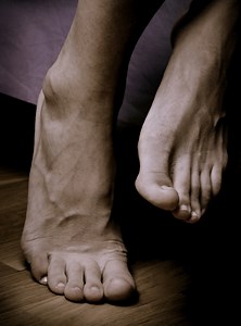 Lack Of Sleep, Genes Can Get Sleepwalkers Up And About