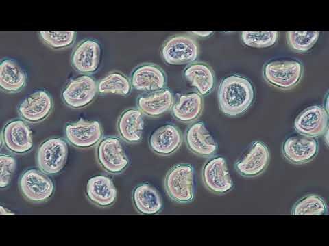 スギ花粉の顕微鏡観察