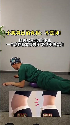 5-Minute Intra-Abdominal Pressure Relief: Your Daily Health Hack