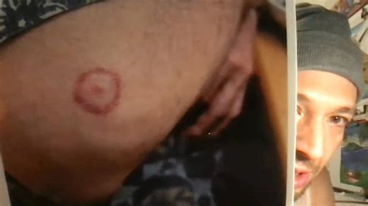 "Truth Day Tuesdays" 1/20/26 (Alien abduction mark? ChatGPT Censorship and the Singularity 2026?!) I could not sign in to Rumble, so now I have to stream from YouTube and then upload the video to other platforms after. I do not know why Rumble won't let me in but I even tried changing the password and restarting the computer. Pathetic someone would aim to stop me from reaching a mere 100 people. A truly weak and criminal regime since they have to censor me, an innocent, unarmed man, who has "no 