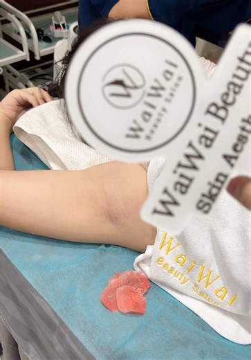 ဂျိုင်း Waxing😍🫶#waiwaibeautysalonmandalay #36လမ်း70x71လမ်းကြား #fypシ゚viral #trending #Waxing