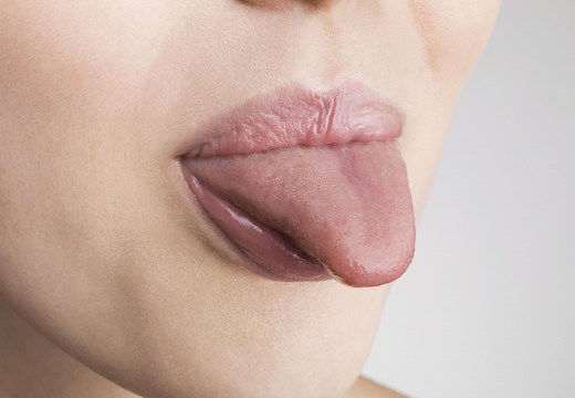 Tongue Exercise? Learn How Myofunctional Therapy May Help Sleep Apnea