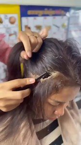 Remove Rid of Dandruff | Remove Dandruff Natural At Home In 1 Day . . . #Dandruff #ridofdandruff #dandruffremoval #dandruffremovalathome #hair #haircare #treandingreels #reelsviralシ #viralreelsfb #treanding #viralvideoシ #fypviralシ #explore | Natural Beauty Remedy