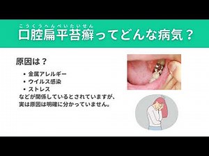 口腔外科医が解説│口腔扁平苔癬とは？原因・症状・治療法をわかりやすく説明