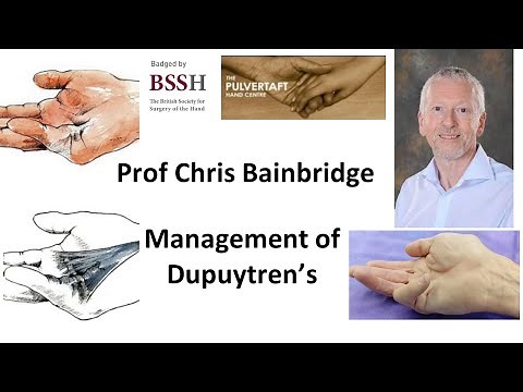 Management of Dupuytren's Contracture by Prof Chris Bainbridge