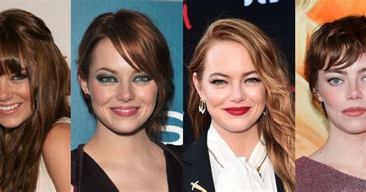 Emma Stone fez lifting facial? 35 fotos do antes e depois da atriz destacam mudança drástica na aparência em 19 anos