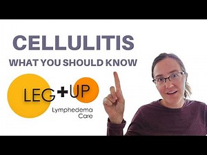 Cellulitis: Causes, Prevention, and Treatment for Lymphedema Patients