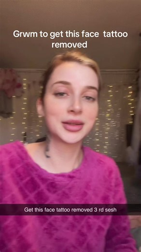 Face Tattoo Removal Journey