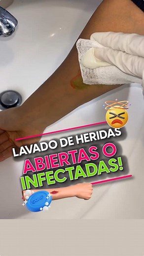 Cómo limpiar y cicatrizar una herida abierta de manera adecuada