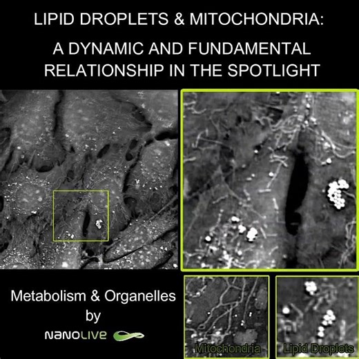 Monitoring lipid droplets and mitochondria label-free