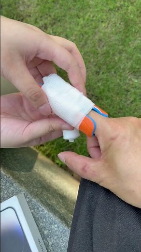 Broken Finger First Aid: What to Do Immediately #firstaid #fracture