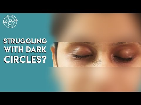 Laser treatment for dark circles under eyes