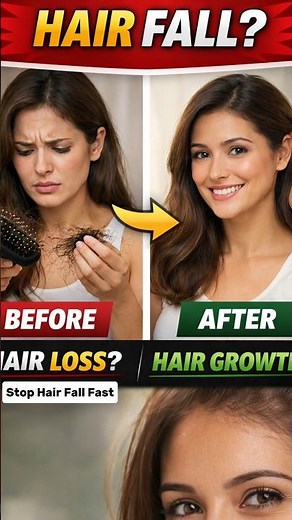 Stop Hair Fall Naturally in 7 Days 🔥 | 2 Best Exercises for Hair Growth (100% Result) #shorts #yoga