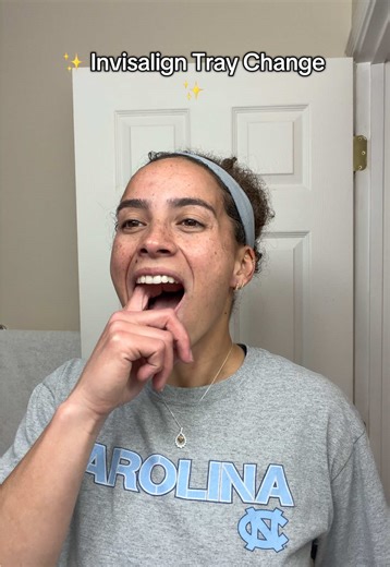 Invisalign Tray Change This Week