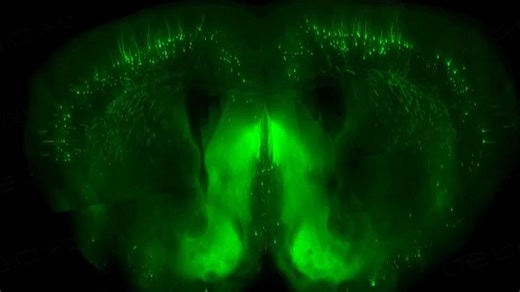 fMOST 技术对柔性电极植入后的全脑尺度三维重构
