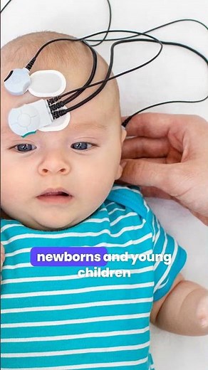 Otoacoustic Emissions (OAE)