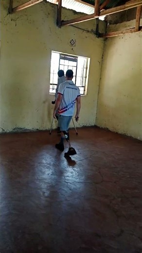 Fitting of Artificial limb