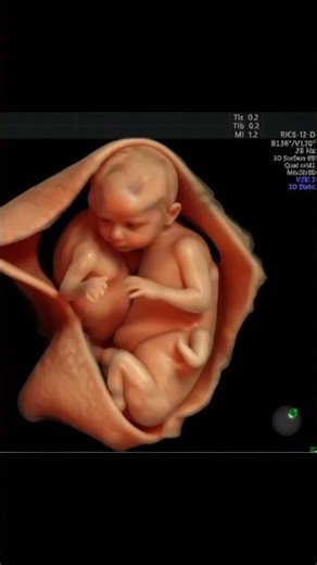 18 Week Twin Unborn Babies in Womb | Fetal Growth & Movement #unbornbaby #development #shorts