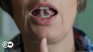 How to cope with stuttering