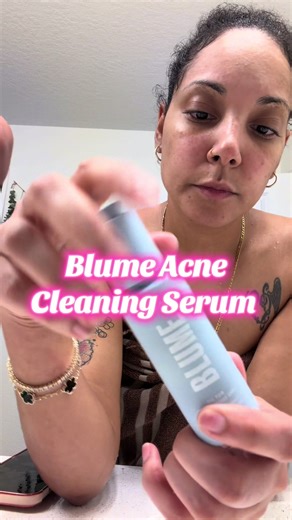 Blume Meltdown Acne Oil: Transform Your Skin Naturally