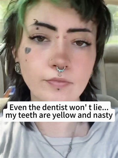 The wrong toothpaste ruined my smile 😭#teethproblems #oralhealth #dentisttok #toothpaste #fyp #usa