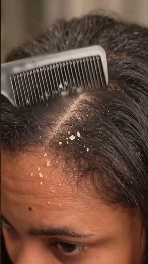 Relax with satisfying scalp scratching and dandruff removal sounds.