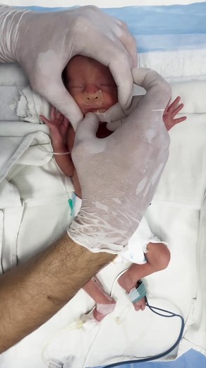 448K views · 3K reactions | #cutebaby #baby #babyfirstbreath #cute | Born Cute Babies | Facebook