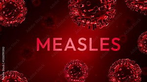 Measles Virus spreading among children around the globe, 4k concept animation in red color with typography. Measles infection, irritation, skin, health.