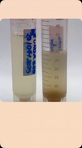 MICROBIOLAB ECUADOR Microorganismos vivos, agricultura consciente En Microbiolab desarrollamos bioinsumos de alta calidad con cepas seleccionadas de hongos y bacterias benéficas. Nuestro objetivo es mejorar la salud del suelo, aumentar la productividad y promover prácticas agrícolas sostenibles. ⸻ Bioinsumos disponibles: • Trichoderma spp. – Control fúngico y promotor del crecimiento • Beauveria bassiana, Metarhizium spp., Lecanicillium lecanii – Control biológico de insectos • Paecilomyces lila