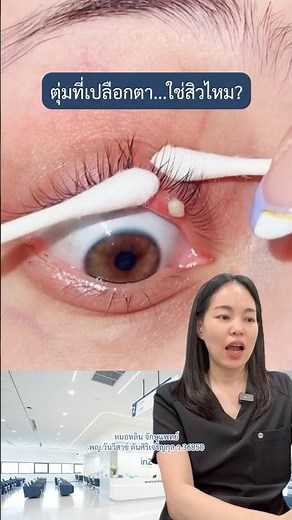 ตุ่มที่เปลือกตา.. ใช่สิวไหม?? #inzhospital #โรงพยาบาลจักษุอินซ์ #จักษุแพทย์ #โรคตา #ตากุ้งยิง
