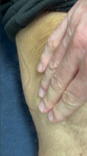 Fluid Bulging from Knee!