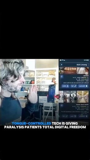 Tongue-Controlled Tech Is Giving Paralysis Patients Total Digital Freedom #techverses