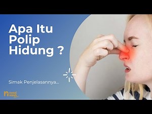 Apa itu polip hidung? #safahhhealth #irigasinasal #sinusitis
