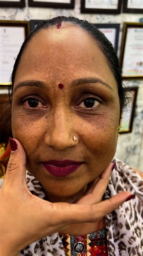 Call - 9220729132 Add- CSC Market, Sec-18B, Dwarka, NewDelhi - 110078 #facetreatment #faceglow #facebrightening #skincare #viral #nishalambha #instagood #pigmentationtreatment | Nisha Lambha - Sparsh Beauty Care & Hair Treatment LLP