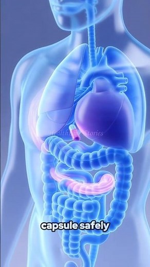 AI Capsule Endoscopy: The Future of Painless Diagnosis