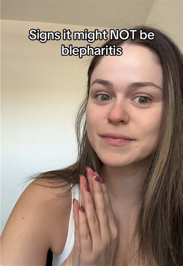 Watery eyes alone ≠ blepharitis. Blepharitis usually involves inflammation of the eyelid margins, flaking at the lash line, crusting, redness, and chronic symptoms. Allergies and dry eye can also cause tearing. If you’re unsure, see an eye doctor. #blepharitis #dryeye #wateryeyes #eyelidinflammation #inflammation