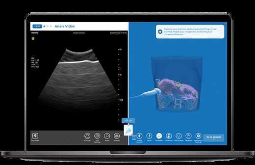 diSplay U/S - Online ultrasound simulator by InSimo