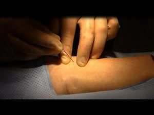 Radial arterial access technique - Teaching module 2