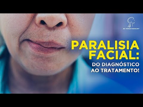 Como Recuperar Seus Movimentos do Rosto: Diagnóstico, Tratamento da Paralisia Facial!
