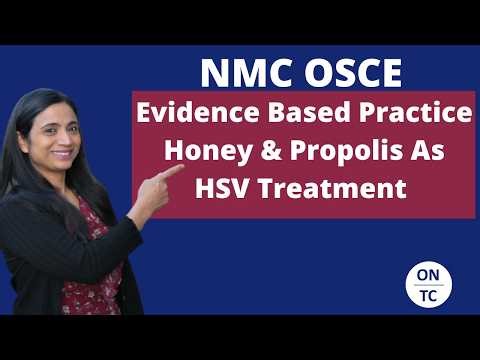 NMC OSCE EVIDENCED BASED PRACTICE HONEY AND PROPOLIS AS HSV TREATMENT